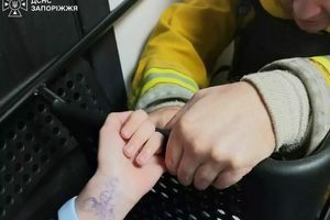 Спасение ребенка в Запорожье: ДСНС освободили палец девочки из ловушки фото